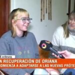 “Que nunca la gente se rinda, que siempre intente ir para adelante”: Oriana Bruno y su lucha tras la amputación de sus piernas​