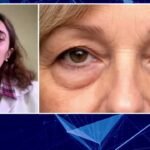 Bolsas y ojeras: por qué la mirada puede hacerte ver más cansado​